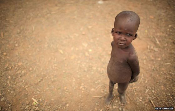_68212467_hunger-boy